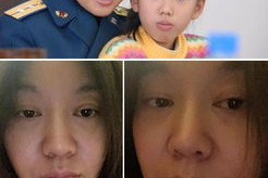 明星割双眼皮前后对比,割双眼皮前后惊人对比揭秘